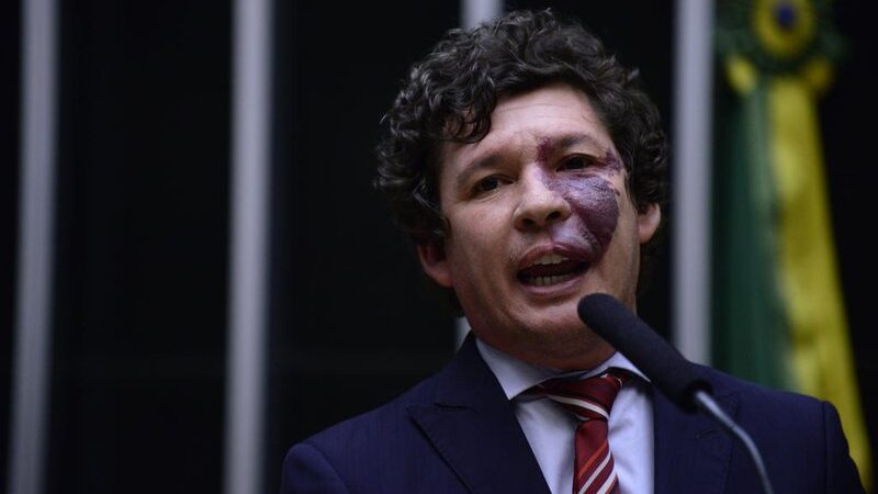 Tudo indica que bancada vai se pronunciar por apoio à reeleição de Lira, segundo Lopes