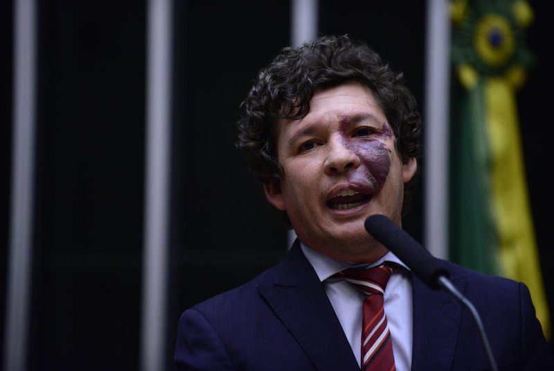 Tudo indica que bancada vai se pronunciar por apoio à reeleição de Lira, segundo Lopes