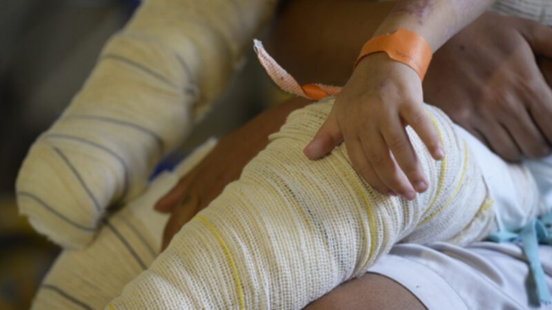 Debate na área da saúde foca na prevenção de queimaduras e diabetes