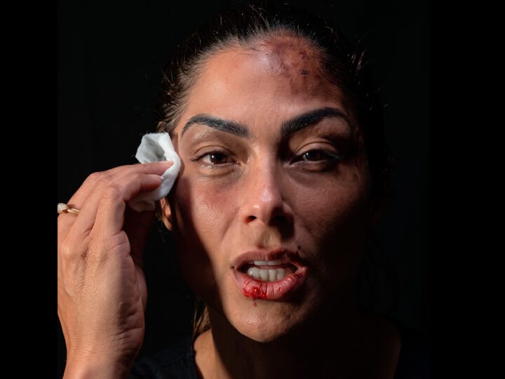 Capitã Andresa surge com o rosto ferido, apaga as marcas e deixa recado poderoso às mulheres