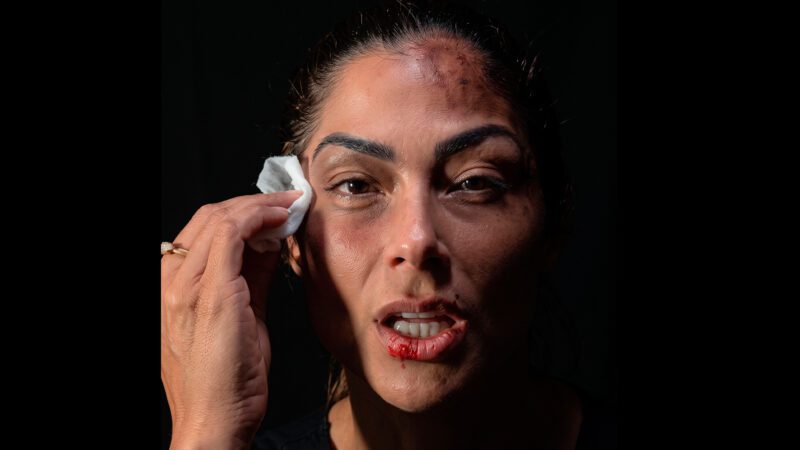 Capitã Andresa surge com o rosto ferido, apaga as marcas e deixa recado poderoso às mulheres
