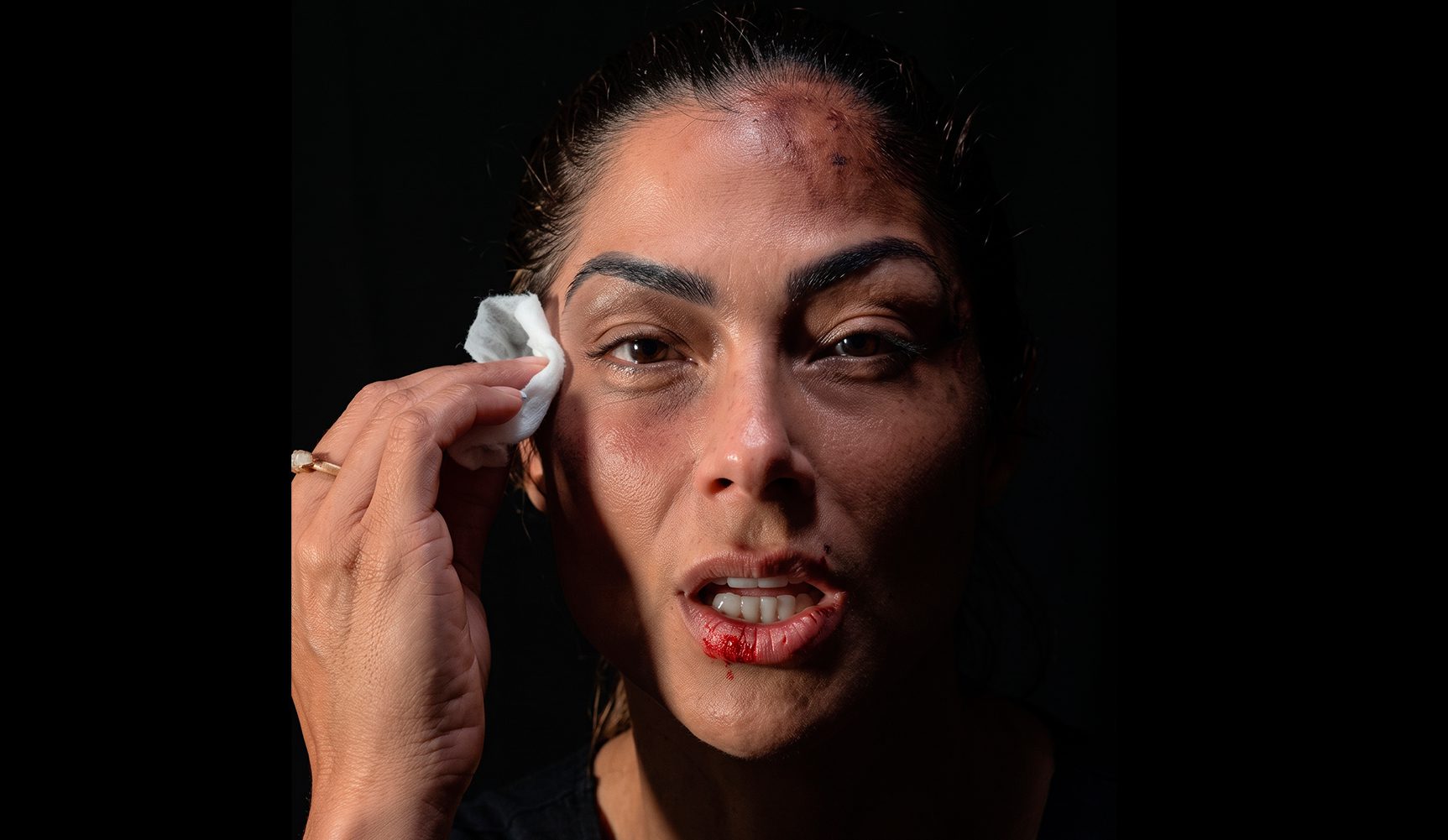 Capitã Andresa surge com o rosto ferido, apaga as marcas e deixa recado poderoso às mulheres